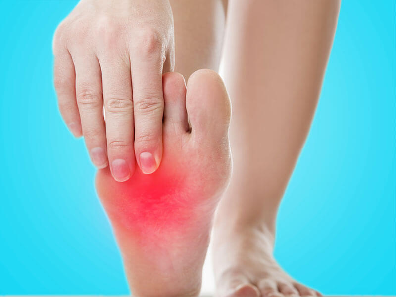 What Is Burning Feet?